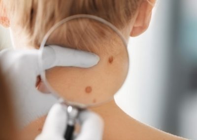Consulta com especialista em cabeça e pescoço