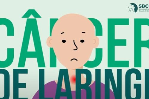 foto cancer de laringe